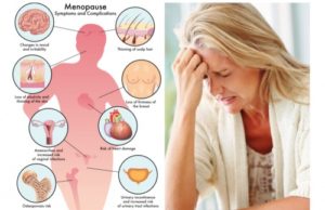 menopause